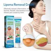 2 Pcs / Lipoma Removal Cream-লাইপোমা রিমুভাল ক্রিম